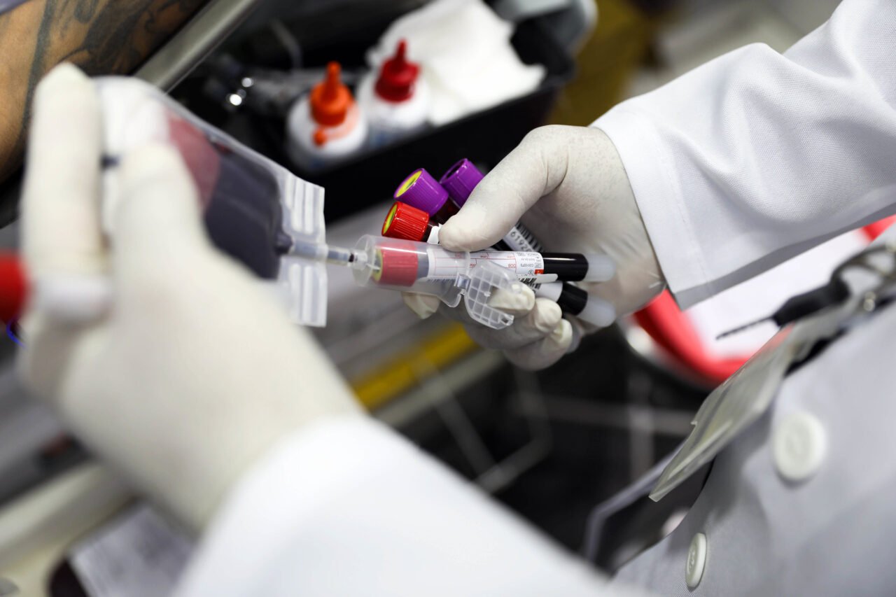 Novos critérios facilitam a doação de sangue no Distrito Federal 2 nb conteudo 4377 1 1790079252 scaled